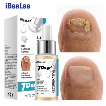 IBeaLee 7DAYS Repair Лечение грибка ногтей Essence Сыворотка для ухода за ногами Ногти на ногах Гель для удаления грибка Противоинфекционный онихомикоз